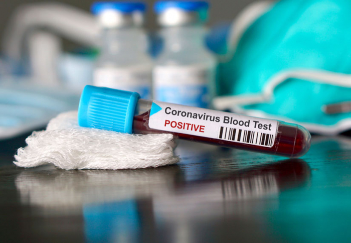 Ситуація з коронавірусом на Закарпатті: у 432 осіб встановлено діагноз COVID-19