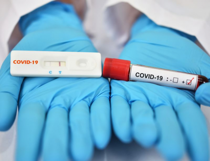 Закарпаття: 644 пацієнтам підтверджено COVID-19