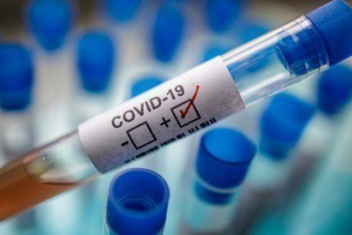 У 341 ужгородця підтверджено COVID-19