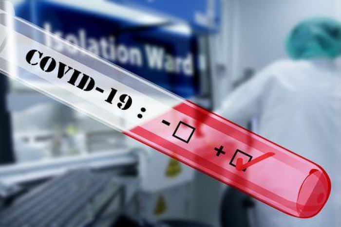 74 нові випадки захворювання на COVID-19 за добу зафіксували на Закарпатті