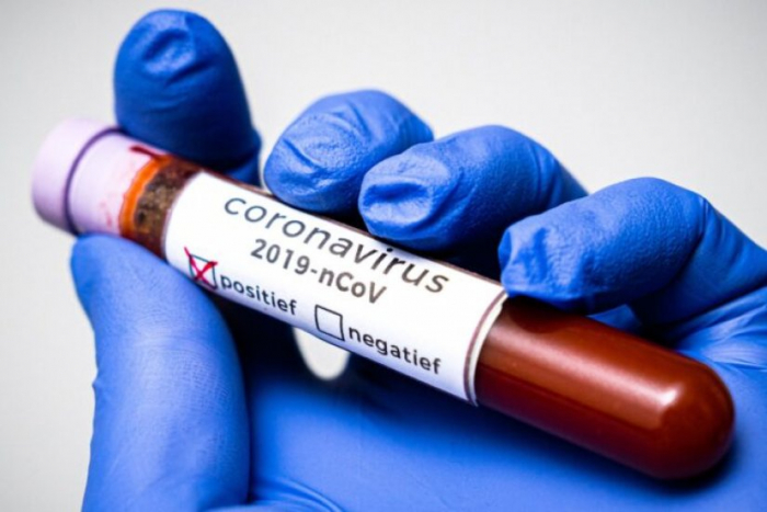 COVID-19 на Закарпатті: ще одна людина померла з підтвердженим коронавірусом
