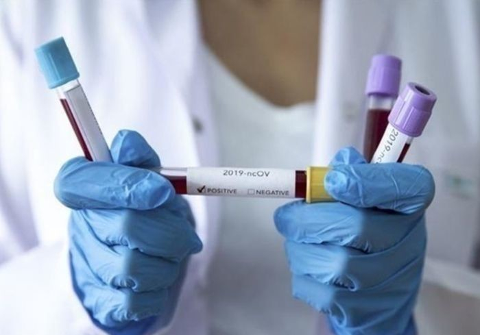 П’ять нових випадків коронавірусної інфекції виявлено за добу в Ужгороді