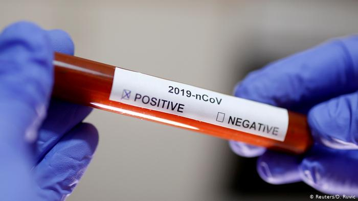 З підтвердженим коронавірусом на Закарпатті вже померло 32 людей