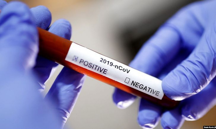 12 нових випадків коронавірусної інфекції виявлено за добу в Ужгороді