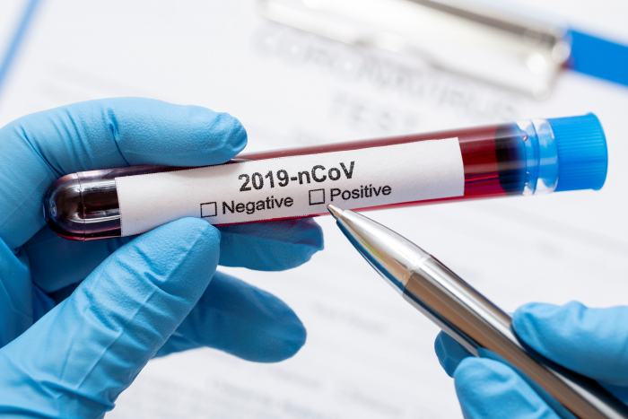 Сім нових випадків коронавірусної інфекції виявлено за минулу добу в Ужгороді