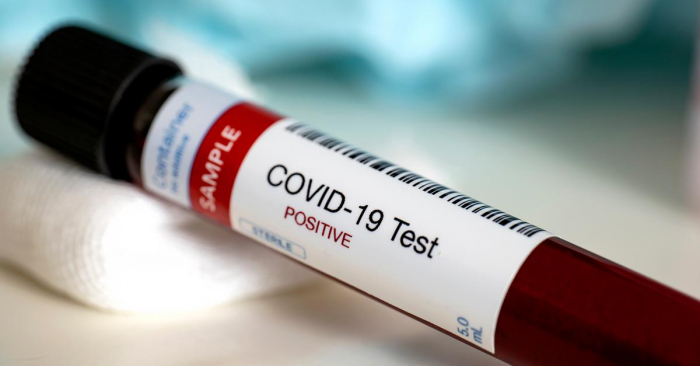 З початку пандемії 667 ужгородців захворіли на COVID-19