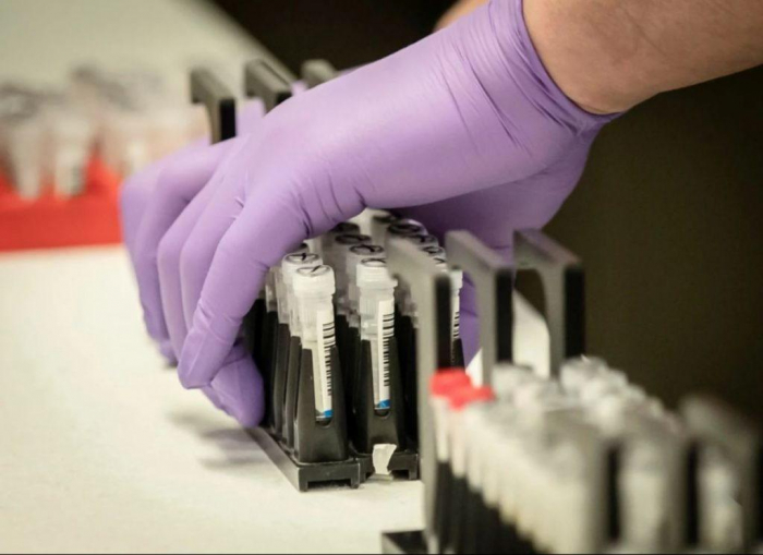 Понад тисячу ІФА-тестів на коронавірус зробили в закарпатському громадському центрі здоров’я