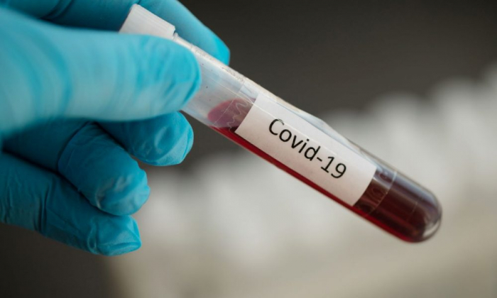 COVID-19 на Закарпатті: за добу майже 90 нових підтверджень коронавірусу