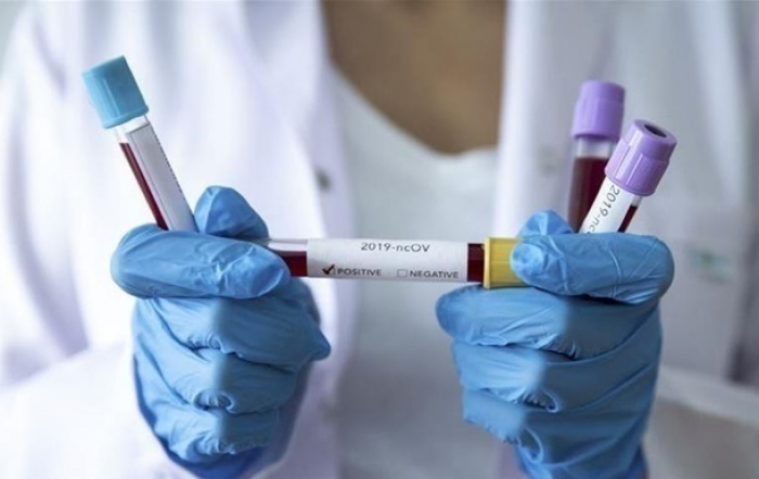 За добу на Закарпатті один пацієнт помер від коронавірусу, 33 захворіли