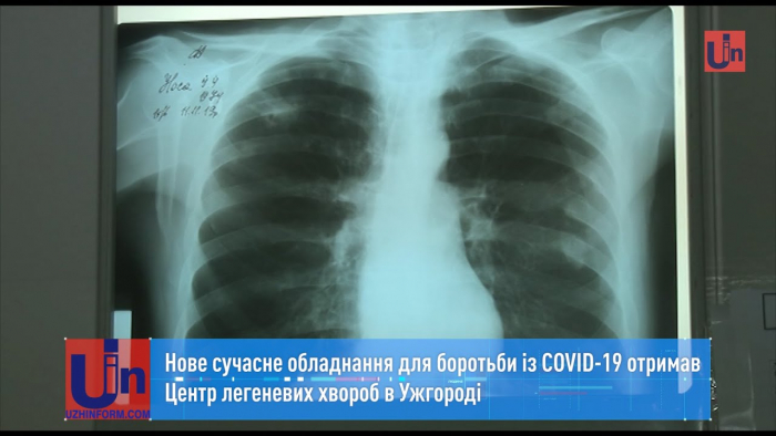 Нове сучасне обладнання для боротьби із COVID-19 отримав Центр легеневих хвороб в Ужгороді (ВІДЕО)
