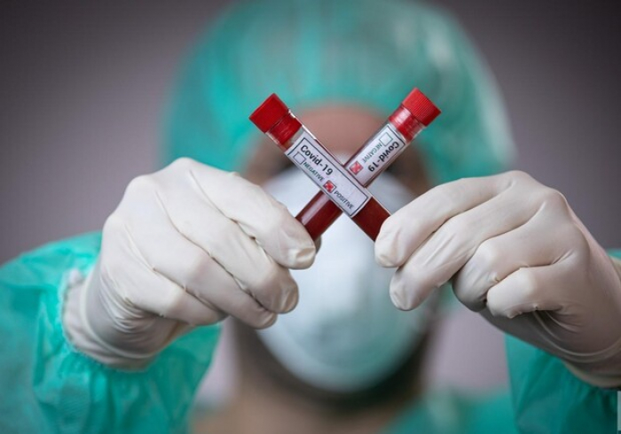 В Ужгороді - нові випадки інфікування коронавірусною інфекцією