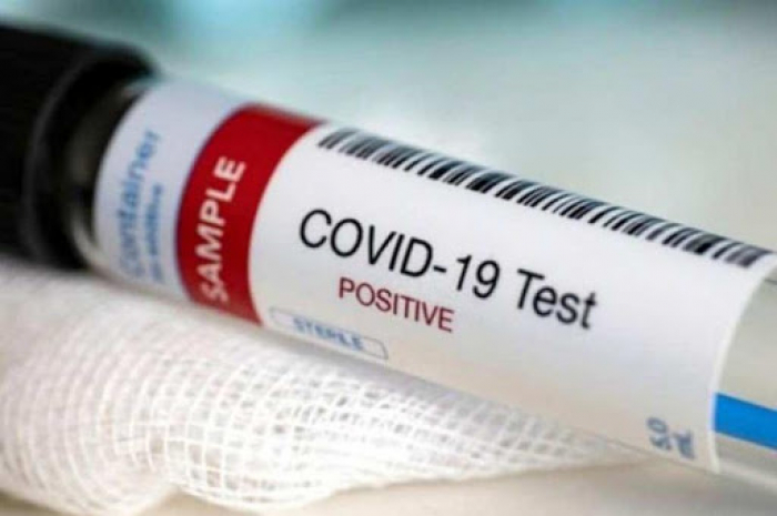 За добу в Ужгороді виявлено 6 нових випадків коронавірусної інфекції, 1 людина померла