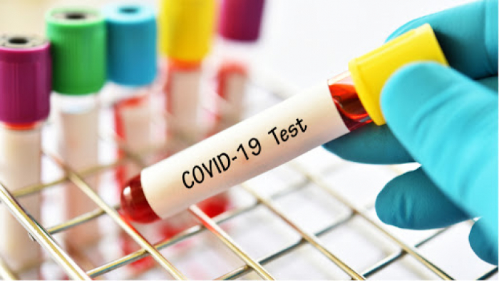 В Ужгороді за добу виявлено 19 нових випадків коронавірусної інфекції