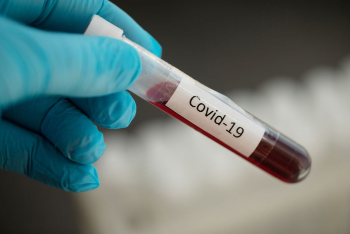 За добу в Ужгороді - 22 нові випадки коронавірусної інфекції 