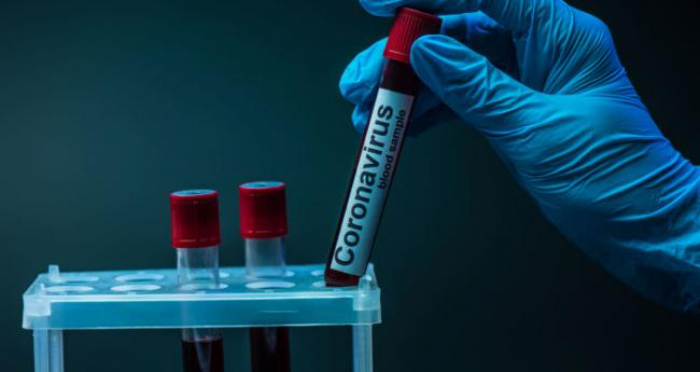 За добу в Ужгороді виявлено 12 нових випадків коронавірусної інфекції