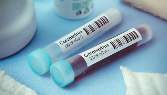 Закарпаття і COVID-19:+ 52 випадки інфікування за добу та один пацієнт помер