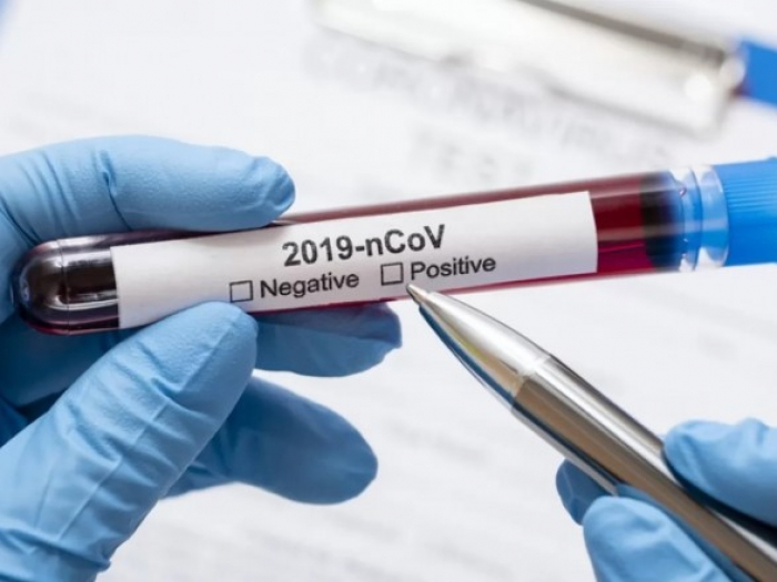В Ужгороді за добу виявлено 15 нових випадків коронавірусної інфекції