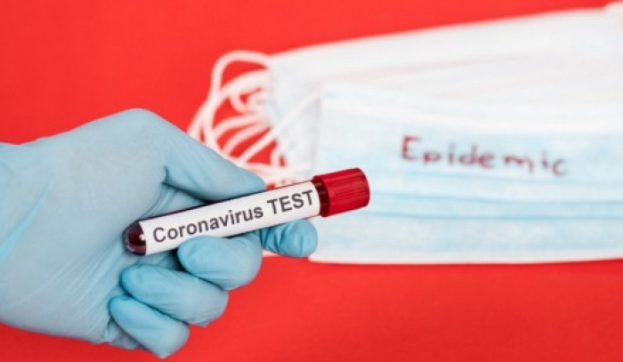 За добу виявлено 17 нових випадків коронавірусної інфекції в Ужгороді