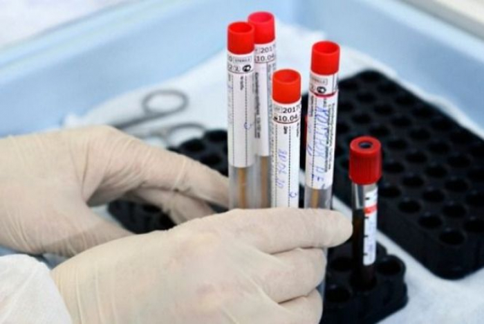 За добу в Ужгороді – 6 нових випадків коронавірусної інфекції