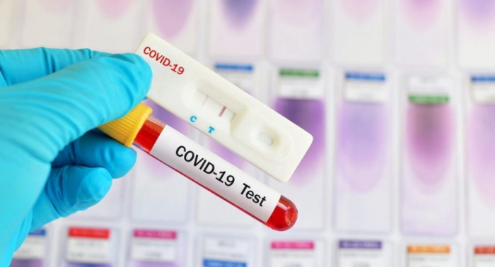 За добу виявлено 19  нових випадків коронавірусної інфекції