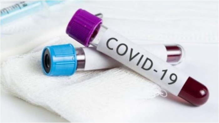 Закарпаття: +50 нових випадків COVID-19 за добу та троє пацієнтів померло