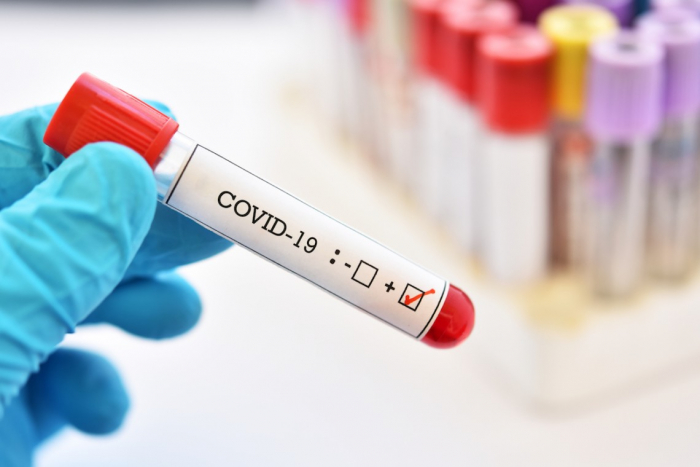 COVID-19 на Закарпатті: за добу померло четверо пацієнтів з підтвердженим вірусом