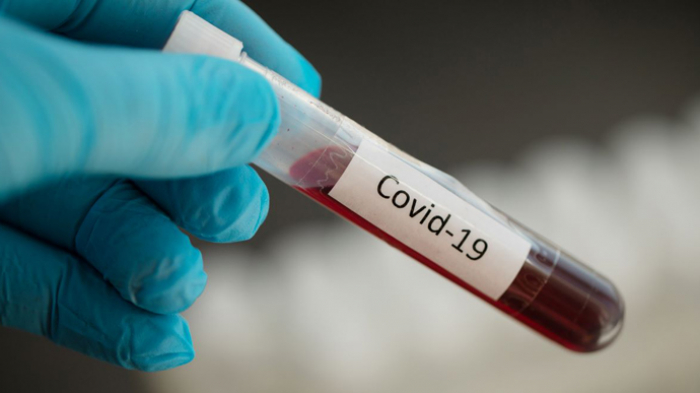 Закарпаття: у 127 пацієнтів підтверджено коронавірус методом ПЛР
