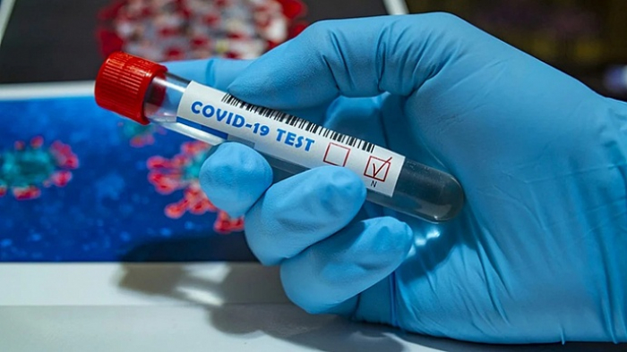COVID-19 на Закарпатті: за добу – у 141 пацієнта підтверджено коронавірус методом ПЛР