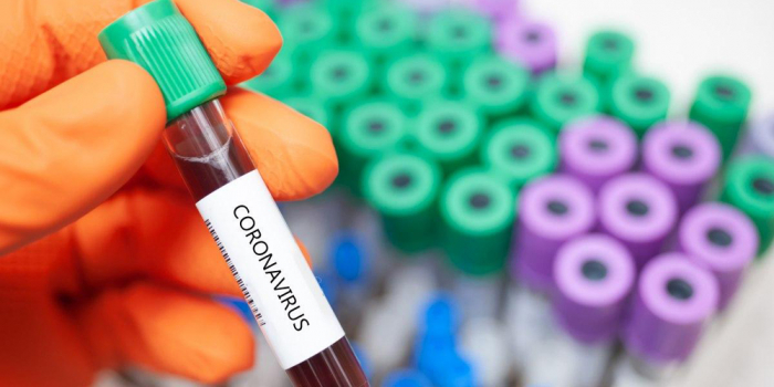 На Закарпатті за добу у 142 пацієнтів підтверджено коронавірус методом ПЛР