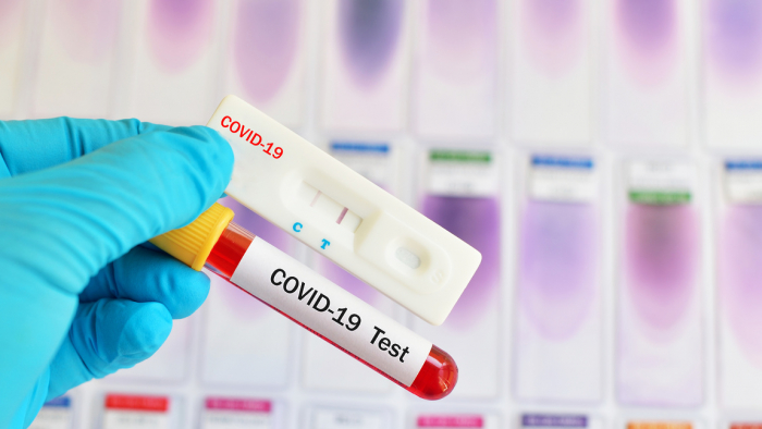 В Ужгороді виявили 26 нових випадків коронавірусу