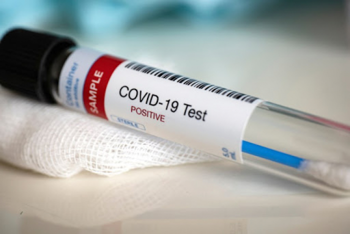 Знову приріст: на Закарпатті коронавірус за минулу добу виявили у 245 людей