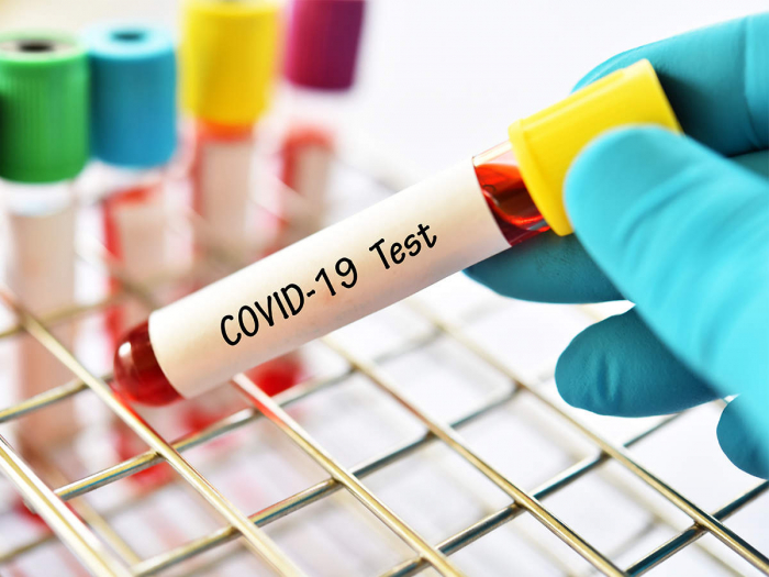 На Закарпатті за добу виявили 47 нових випадків COVID-19