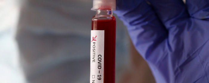 На Закарпатті за добу виявили понад 400 випадків COVID-19. 12 людей померли