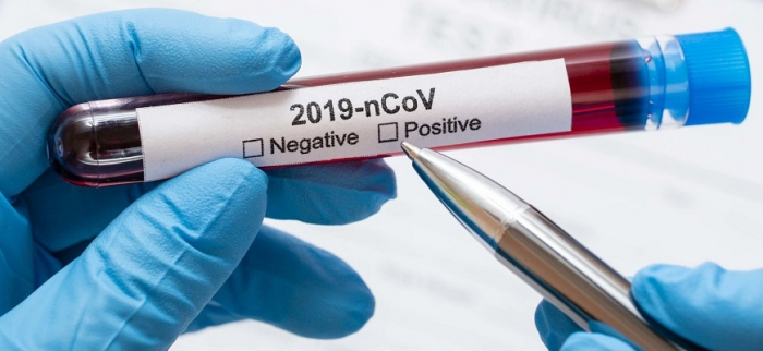 На Закарпатті за добу виявили понад 100 нових випадків COVID-19