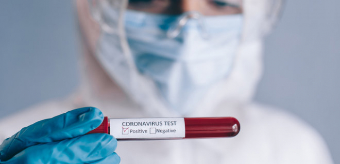 В Ужгороді за добу виявлено 37 нових випадків коронавірусної інфекції, одна людина померла