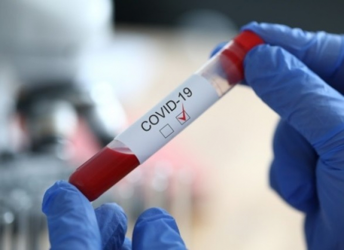 COVID-19 в Закарпатті не відступає: 397 випадків за добу, померли 7 пацієнтів