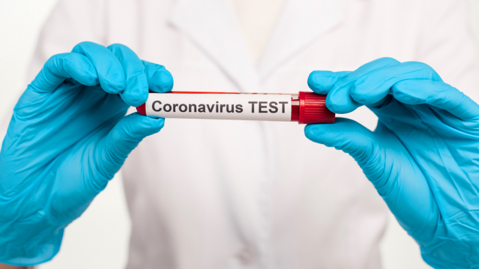 В Ужгороді за добу додались 74 нові випадки коронавірусної інфекції, четверо людей померли