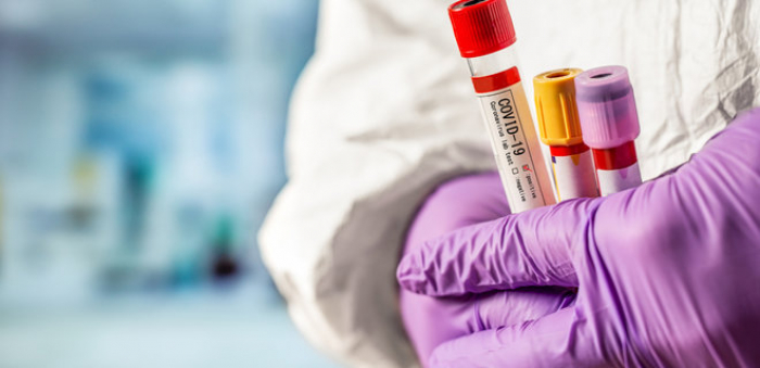 COVID-19 на Закарпатті: ще 311 інфікованих та 7 пацієнтів померло протягом доби