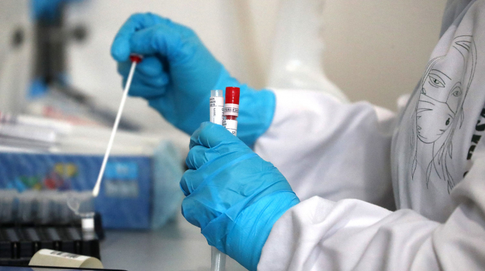 За минулу добу в Ужгороді виявлено 73  нові випадки коронавірусної інфекції