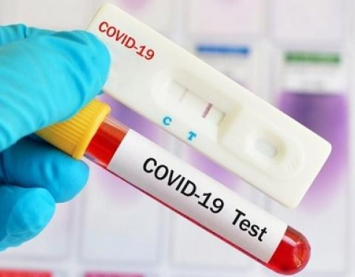 COVID-19 на Закарпатті: 162 нові випадки за добу, померли 4 пацієнти