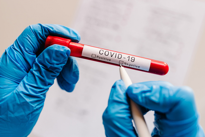 В Ужгороді за добу виявлено 2 нові випадки коронавірусної інфекції