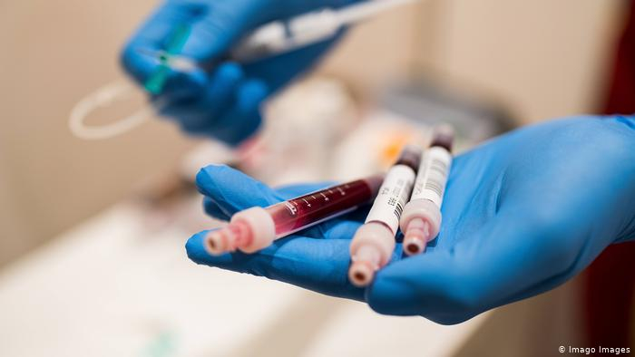 За минулу добу в Ужгороді виявлено 3 нові випадки коронавірусної інфекції