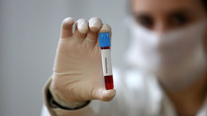 В Ужгороді виявлено 3 нові випадки коронавірусної інфекції протягом доби