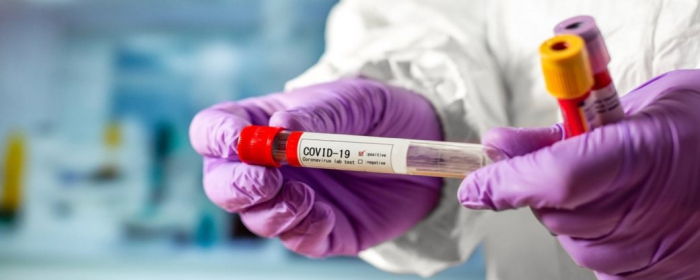 За добу на Закарпатті виявили 20 нових випадків захворювання на COVID-19