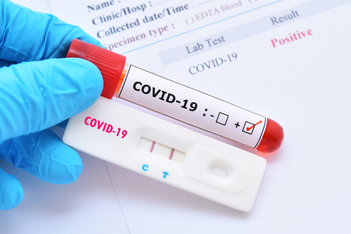 За останню добу на Закарпатті виявлено 13 випадків з COVID-19