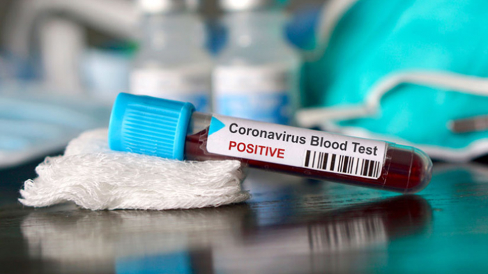 COVID-19 на Закарпатті: за добу – всього 14 випадків захворюваності