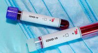 Жодного випадку COVID-19 не зафіксували на Закарпатті за минулу добу