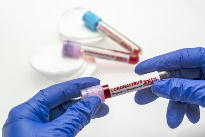 На Закарпатті – 5 нових випадків коронавірусу за добу, 1 людина померла