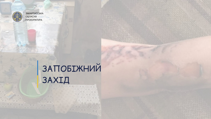 Жителя Ужгорода взято під варту за підозрою у побитті співмешканки до смерті