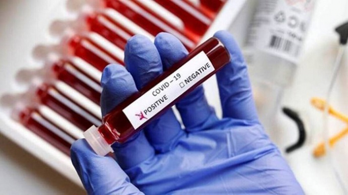 За добу в Ужгороді виявлено 5 нових випадків коронавірусної інфекції